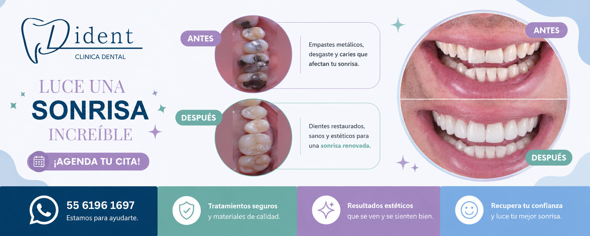 Promoción Dident 6